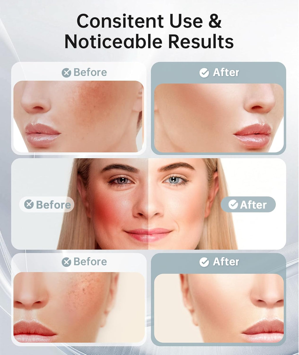 Radiant Glow Light Therapy Massager